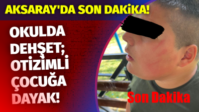 Aksaray’da otizmli çocuğa okulda şiddet iddiası: Aile ve Dernekler ayağa