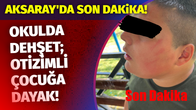 Aksaray’da okulda dehşet: otizmli çocuğa dayak!