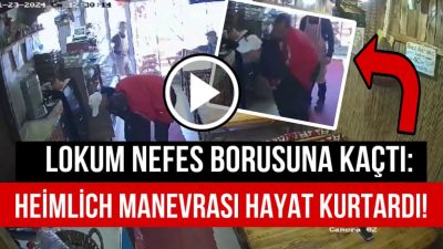Aksaray’da bir lokantada nefes borusuna lokum kaçan down sendromlu vatandaş,