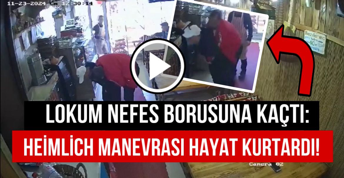 Lokum nefes borusuna kaçtı: Heimlich manevrası hayat kurtardı!