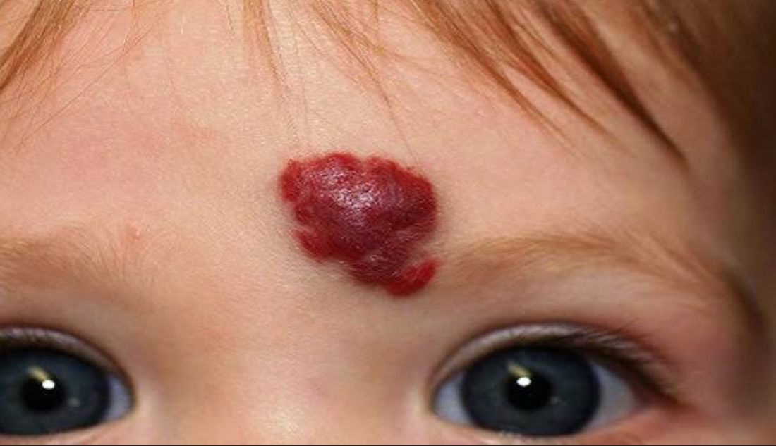 Özel İnova Hastanesi Çocuk Sağlığı ve Hastalıkları Uzmanı Doktor Ebubekir