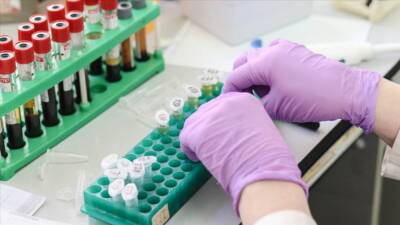 Biruni Üniversitesi Tıp Fakültesi Hastanesi Hematoloji Uzmanı Prof. Dr. Ali