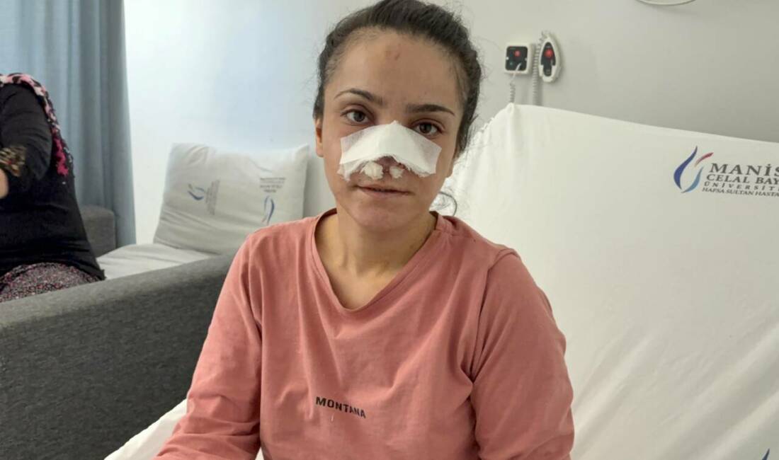 Eşinin burnunu ısırarak kopardı! Manisa'nın Turgutlu ilçesinde eşi tarafından darp edilerek burnu ısırılıp koparılan