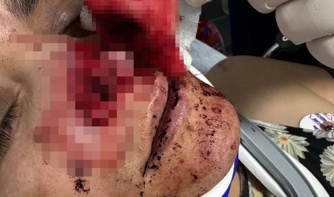 Manisa'nın Turgutlu ilçesinde eşi tarafından