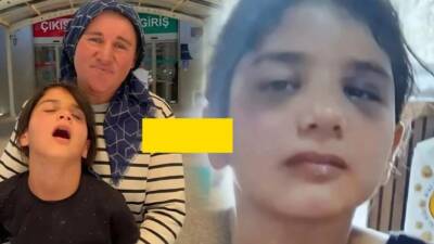 Aile ve Sosyal Hizmetler Bakanlığı, Aksaray'da komşuları tarafından darbedilen özel